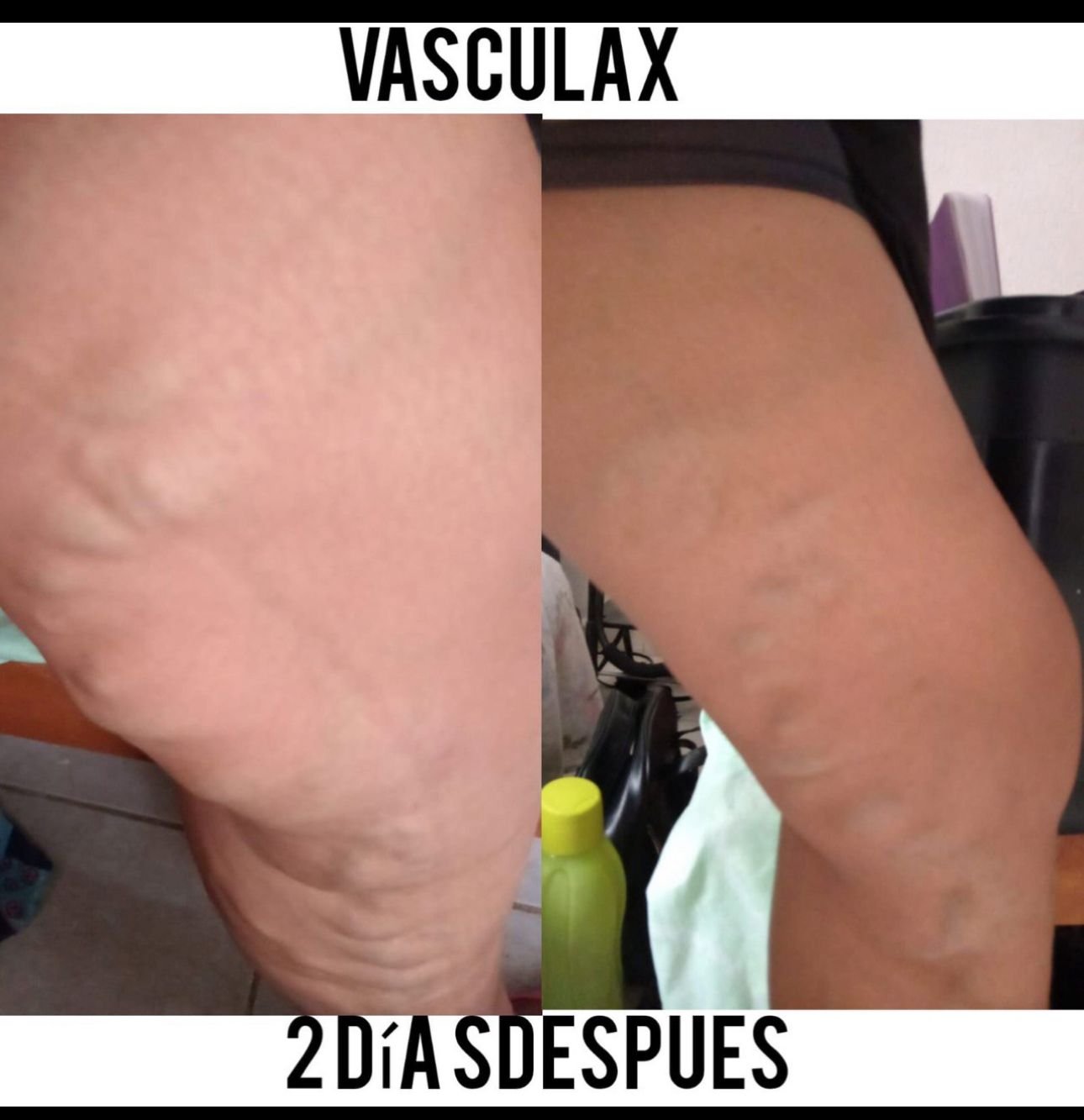 Testimonio 2