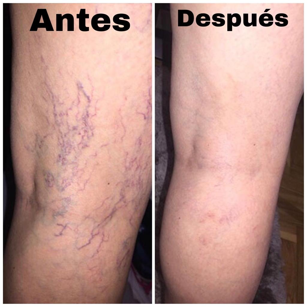 Testimonio 4